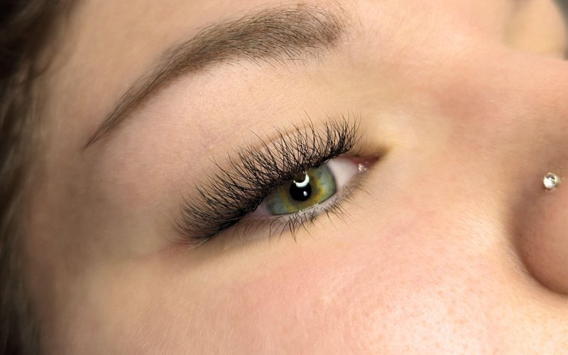 Extensii gene (dupa)